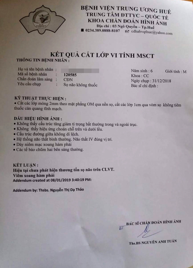 Kết luận của Bệnh viện Trung ương Huế.