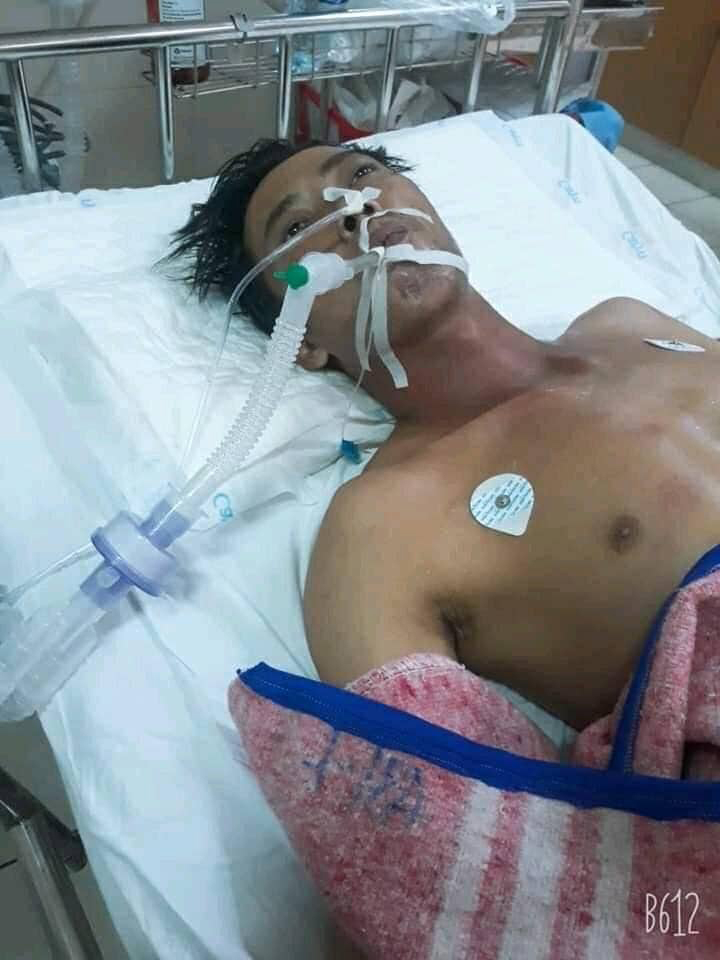 Anh Nguyễn Văn Phượng đang điều trị tại Khoa Hồi sức cấp cứu, Bệnh viện Trung ương Huế.