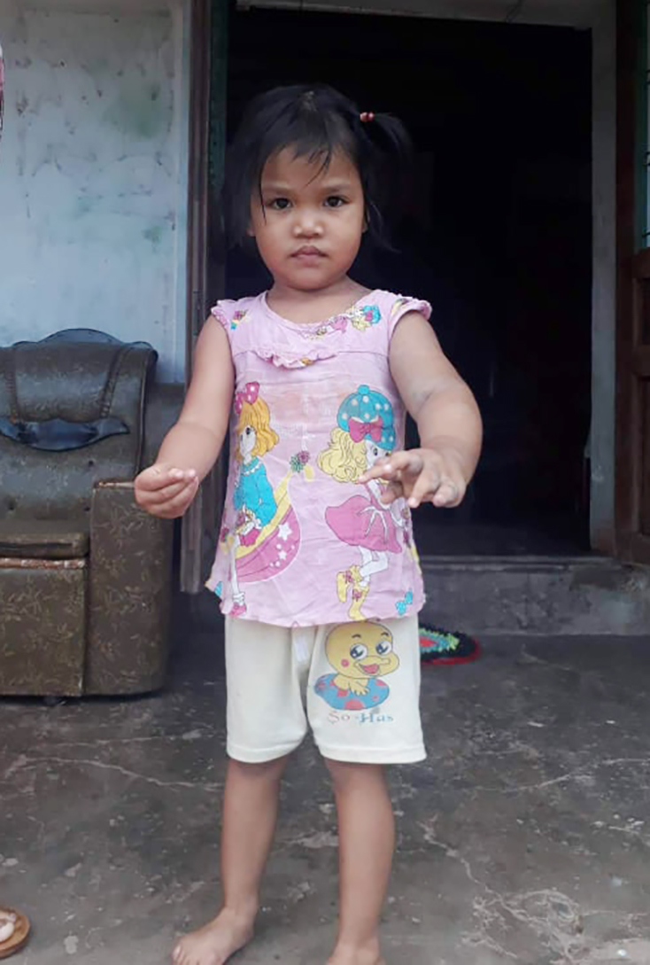 Cháu Phan Hoàng Bảo Trâm với cánh tay mềm, nổi đầy sần. 
