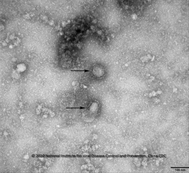 Virus corona mới, được cho là nguyên nhân gây ra dịch viêm phổi lạ tại Vũ Hán, Trung Quốc. Ảnh: Yonhap/TTXVN