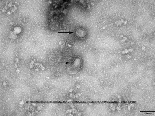 Virus corona mới, được cho là nguyên nhân gây ra dịch viêm phổi lạ tại Vũ Hán, Trung Quốc. (Ảnh: Yonhap/ TTXVN)