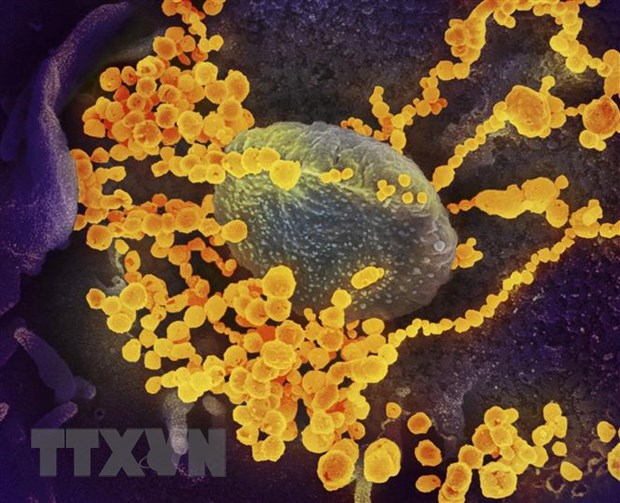 Hình ảnh virus SARS-CoV-2 (màu vàng) nổi lên bề mặt tế bào người. (Ảnh: AFP/TTXVN)