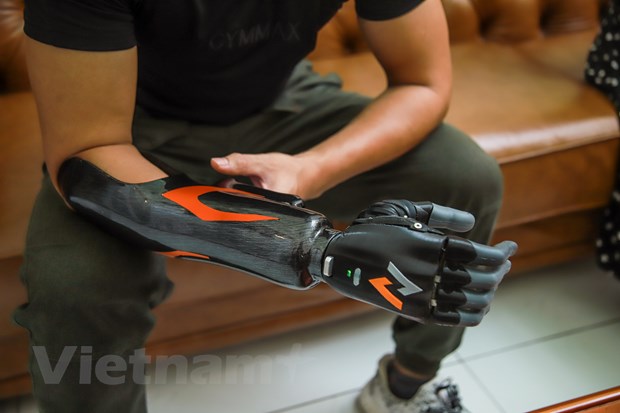 Nhờ cánh tay robot, Hoàng Văn Dũng, 28 tuổi (Hà Nội) đã có thể tự làm mọi việc, chống đẩy rèn luyện sức khỏe, thậm chí tự lái xe đi làm. Thời gian trước, anh lên mạng tìm hiểu những sản phẩm xuất xứ nước ngoài giá vài trăm triệu cho tới gần 2 tỷ/tay. Sau đó, anh may mắn được biết và là một trong những người đầu tiên dùng tay robot Vulcal. (Ảnh: Minh Sơn/Vietnam+)