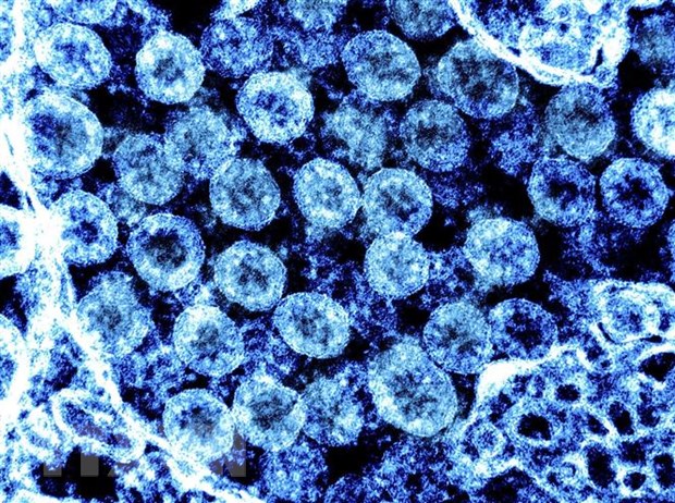 (Hình ảnh do Viện Y tế Quốc gia Mỹ (NIH) cung cấp) Virus SARS-CoV-2 chụp qua kính hiển vi điện tử trên mẫu bệnh phẩm tại phòng thí nghiệm ngày 1-8. (Ảnh: AFP/TTXVN)