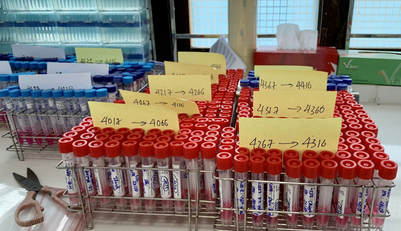 Ngày cao điểm, CDC xét nghiệm từ 60-70 nghìn mẫu.