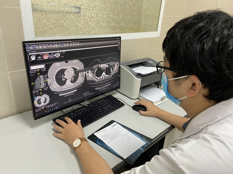 Hình ảnh phim của 1 bệnh nhân tổn thương phổi do COVID-19. Ảnh Bệnh viện Thanh Nhàn