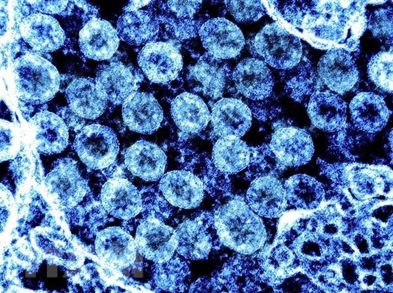 Phần tử virus SARS-CoV-2 trong mẫu bệnh phẩm của bệnh nhân mắc COVID-19. (Ảnh: AFP/TTXVN)