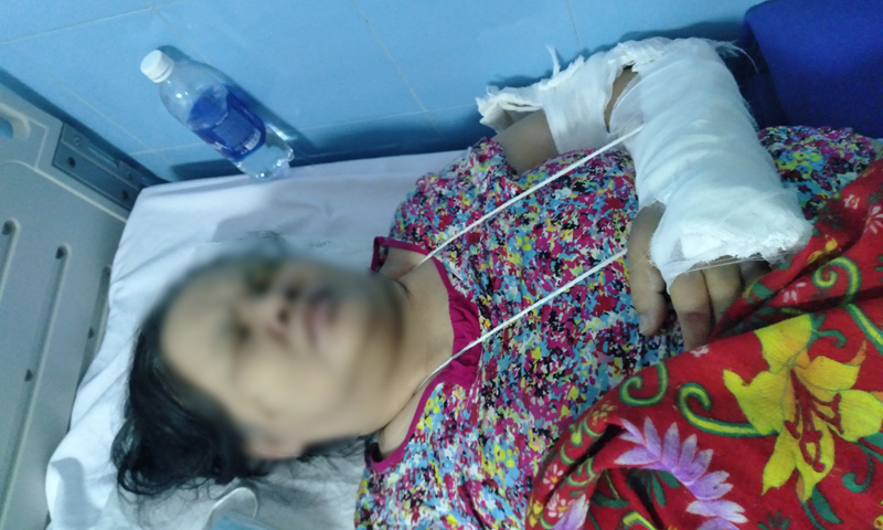 Bà Phan Thị N. phải điều trị bệnh tiểu đường trước khi được mổ sắp lại cánh tay bị gãy.
