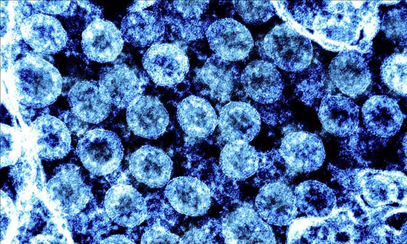 Virus SARS-CoV-2 chụp qua kính hiển vi điện tử trên mẫu bệnh phẩm tại phòng thí nghiệm. Ảnh: AFP/TTXVN