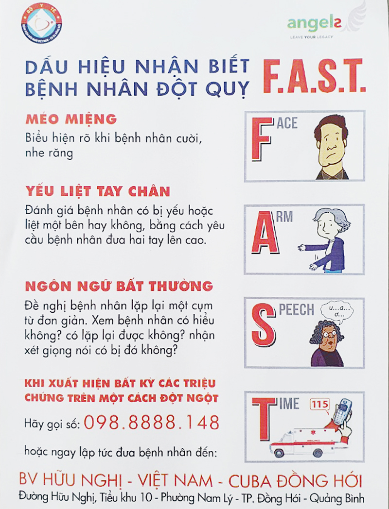 Người dân cần nắm rõ những dấu hiệu nhận biết bệnh nhân đột quỵ để gọi ngay cho y tế cấp cứu trong khoảng “thời gian vàng” tránh tử vong và để lại di chứng nặng nề suốt đời.