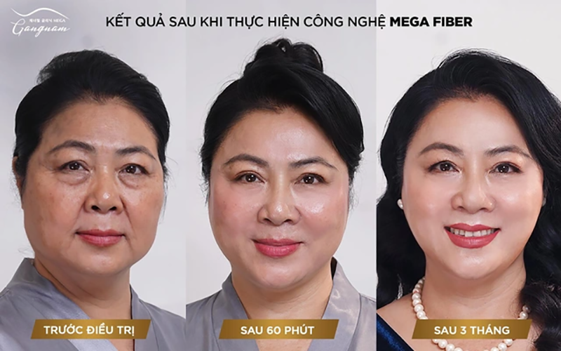 Trẻ hóa làn da nhờ vào công nghệ chăm sóc da mặt chuyên nghiệp