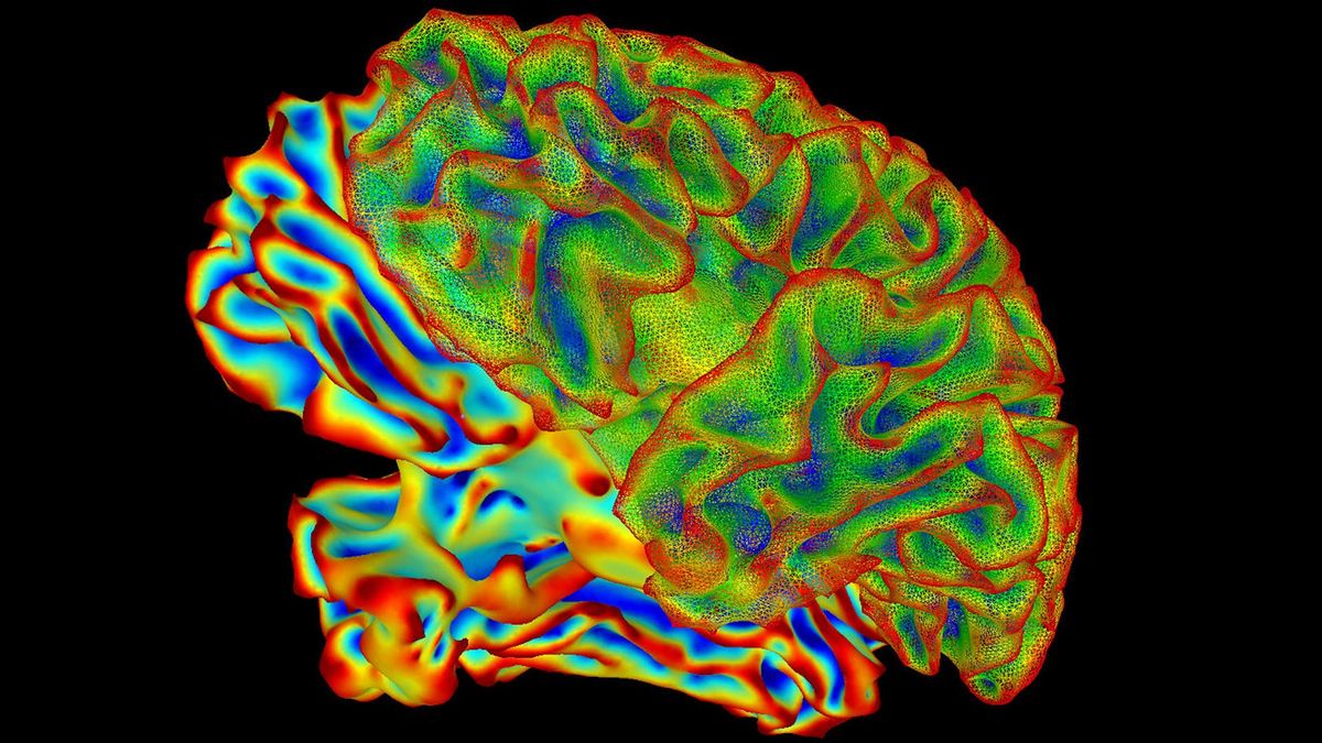 Mang thai gây thay đổi cấu trúc não. Ảnh: Live Science