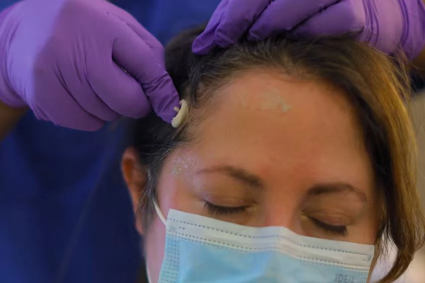 Một chuyên gia đo đa ký giấc ngủ chuẩn bị cho một người tham gia nghiên cứu giấc ngủ tại Boston, Massachusetts, Hoa Kỳ. Ảnh: REUTERS