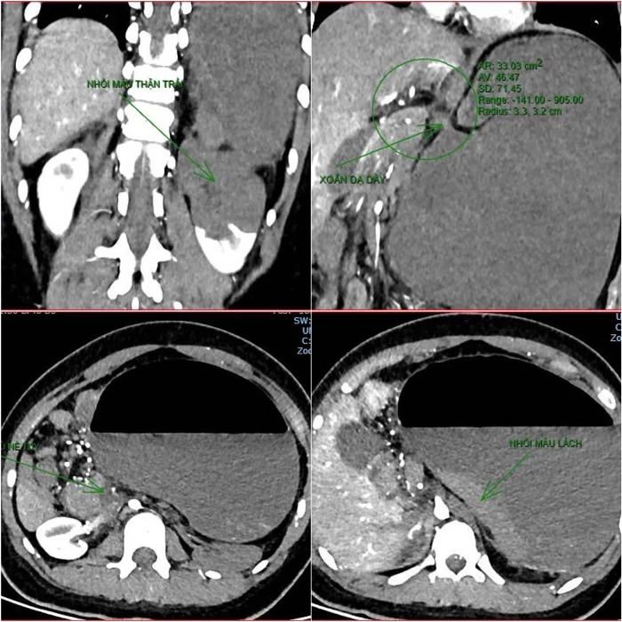 Bệnh viện Hữu nghị Việt Nam - Cuba Đồng Hới thông tin về ca bệnh tử vong