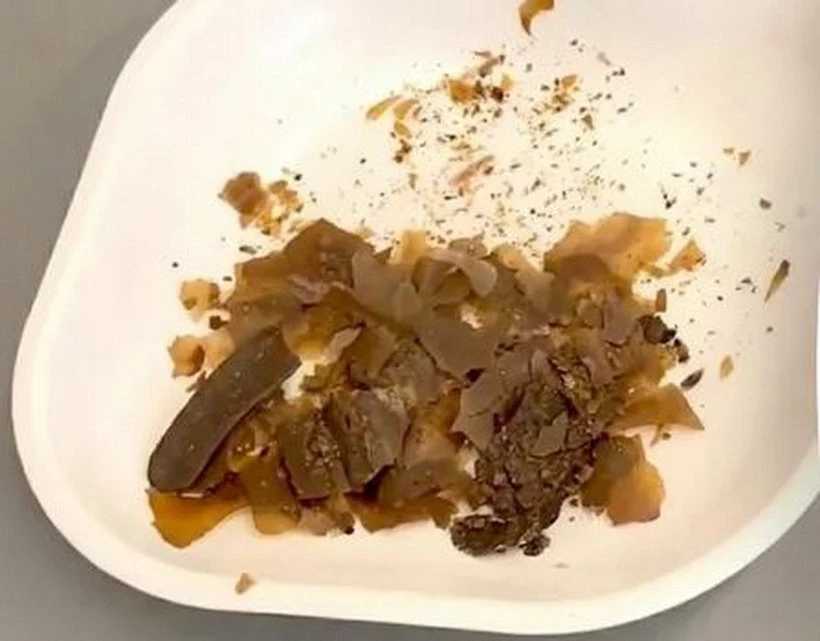 Các nhà nghiên cứu cho biết cặn bã được tìm thấy trong một chiếc bình cổ thời La Mã cung cấp bằng chứng hóa học đầu tiên về việc sử dụng phân làm thuốc. (Ảnh: Getty Images)