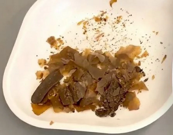 Khám phá mới về cách người La Mã cổ đại điều trị y học