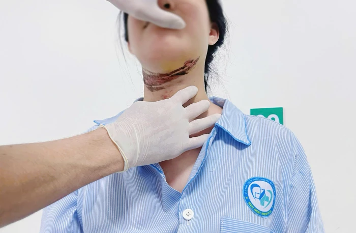 Nữ sinh nhập viện vì vướng dây điện trên đường đi học về