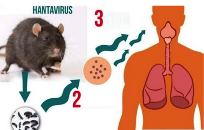 Bộ Y tế khuyến cáo về virus Hanta sau chùm ca tử vong ở tàu du lịch nước ngoài