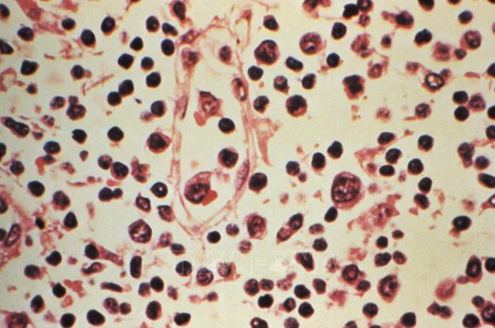 Virus Hanta: Israel ghi nhận ca nhiễm đầu tiên ở trong nước