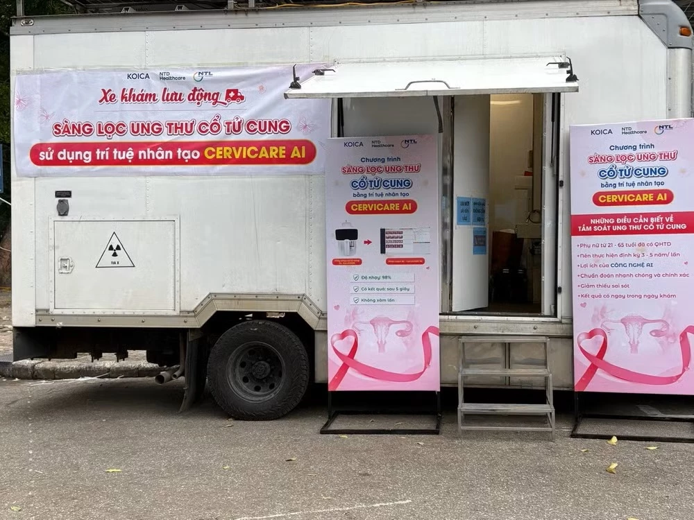 Xe khám sàng lọc ung thư cổ tử cung lưu động. (Ảnh: PV/Vietnam+)