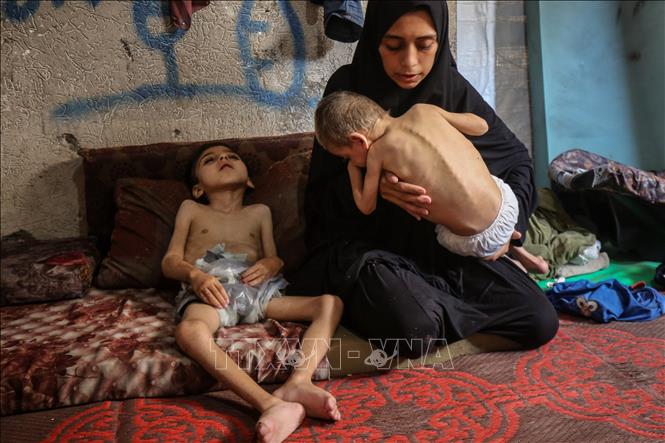 Trẻ em Gaza bị suy dinh dưỡng. Ảnh: THX/TTXV