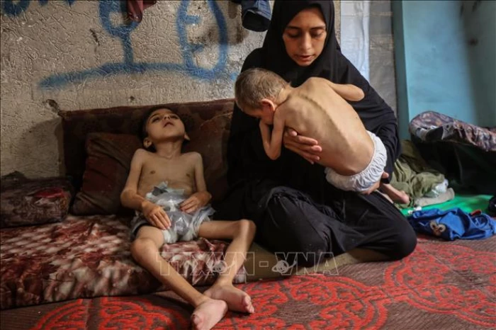Hàng nghìn trẻ em ở Gaza nhập viện vì suy dinh dưỡng cấp tính