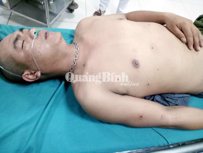 Một công nhân trang trại bị bắn trọng thương
