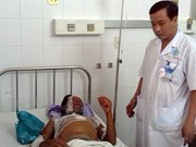 Đi ăn cỗ cưới, 8 người bị bỏng nặng vì bếp cồn bắt lửa
