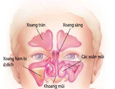 Phòng viêm mũi xoang lúc chuyển mùa