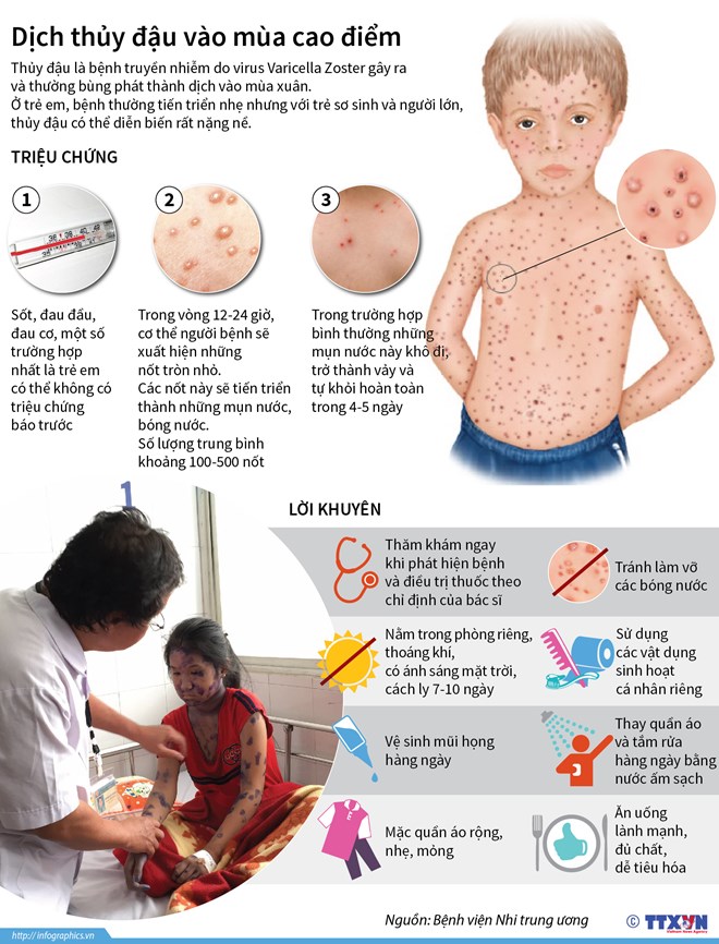 [Infographics] Những triệu chứng thường gặp của bệnh thủy đậu