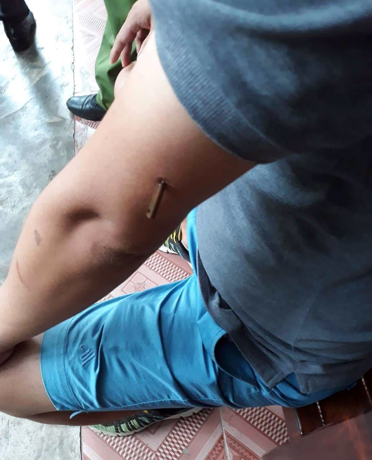Điều tra vụ nổ súng ở quán cà phê