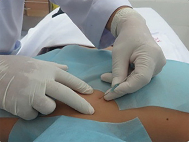 Dân văn phòng dễ bị hội chứng cổ vai