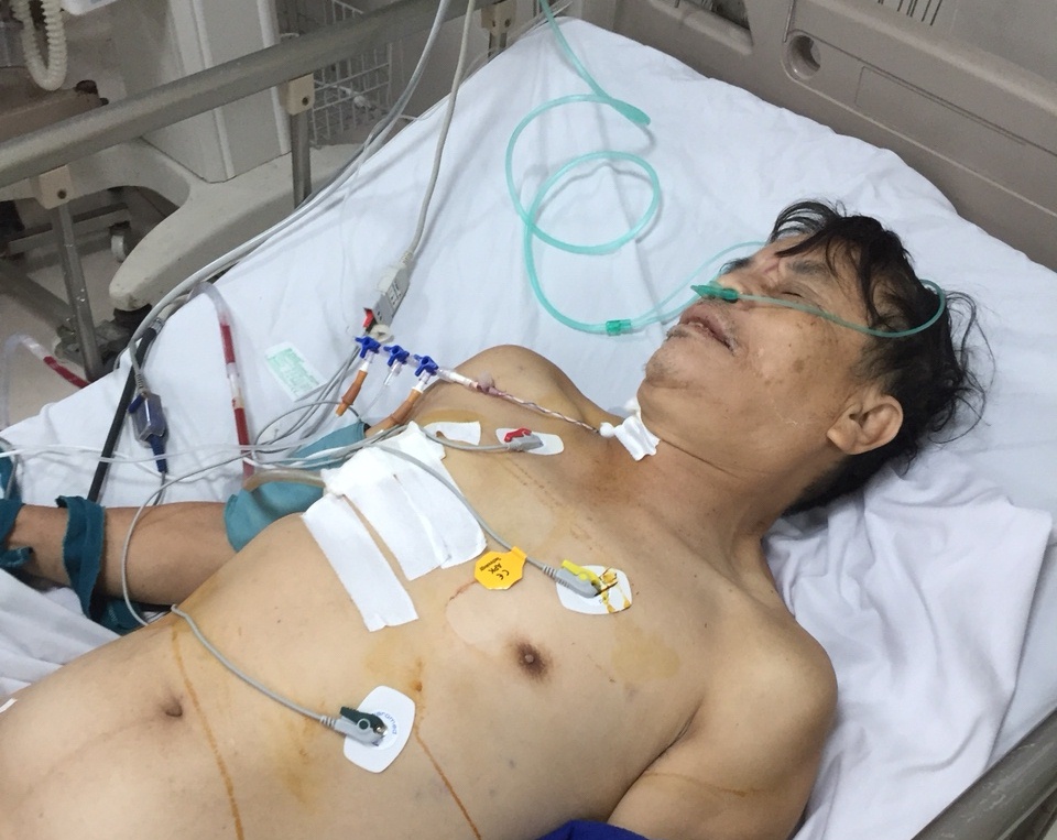 Cứu sống một bệnh nhân bị vỡ tim