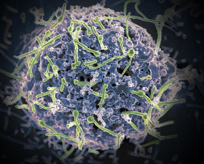 Lần đầu tiên phát hiện virus Ebola ký sinh trên dơi tại Tây Phi