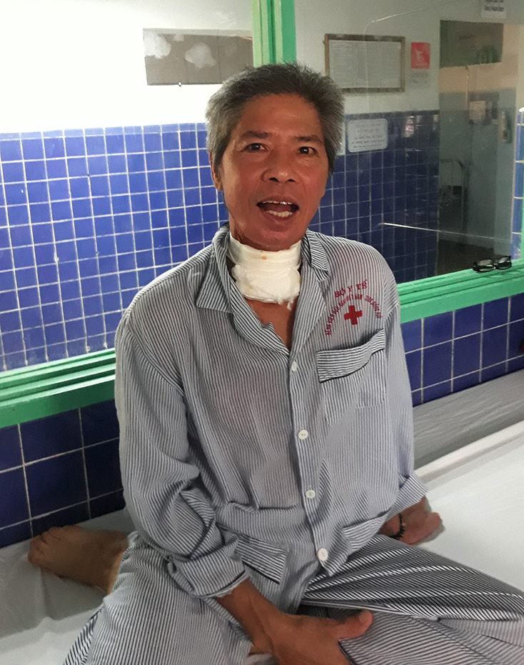 Phẫu thuật cắt bỏ đoạn xương hàm bị tiêu xương cho bệnh nhân ung thư