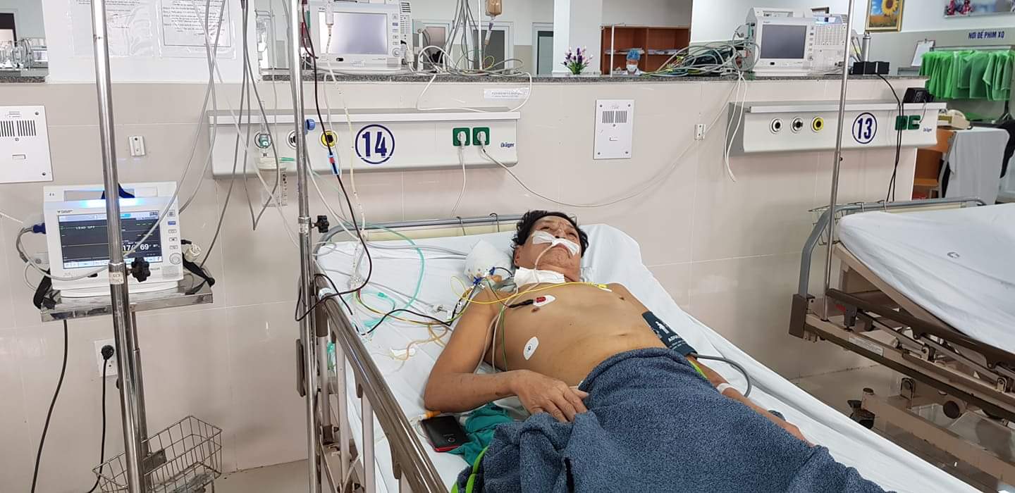 Nút mạch điều trị thành công trường hợp u gan vỡ do chấn thương