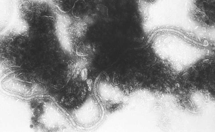 Nhà khoa học Chile tìm ra vắcxin chống virus gây viêm phổi cấp