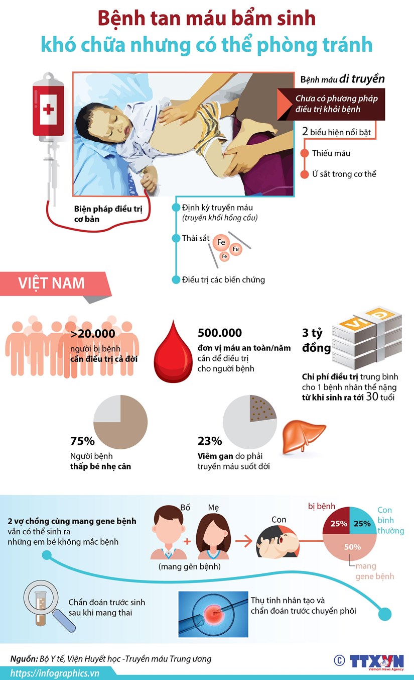 Bệnh tan máu bẩm sinh khó chữa nhưng có thể phòng tránh
