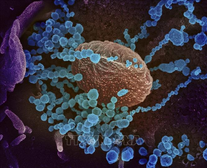 Các nhà khoa học kêu gọi WHO công nhận virus SARS-CoV-2 lây truyền qua không khí